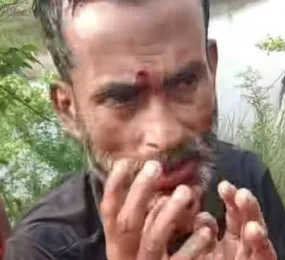 বিজয়নগরে আসামি নিয়ে আদালতে যাওয়ার পথে পুলিশের গাড়ি খাদে, আহত ১