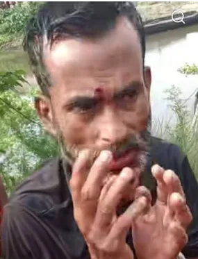 বিজয়নগরে আসামি নিয়ে আদালতে যাওয়ার পথে পুলিশের গাড়ি খাদে, আহত ১
