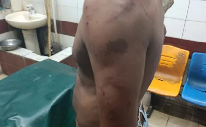 ব্রাহ্মণবাড়িয়ায় তিতাস ট্রেনের কাউন্টারের স্টাফদের আবারও রক্তক্ষয়ী হামলা, টিকিট বই ও টাকা লুট, আহত ১